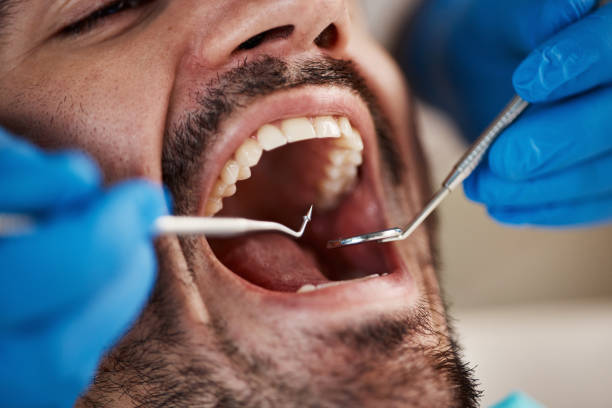 Best Broken or Chipped Tooth Repair in Piney Point Village, TX
