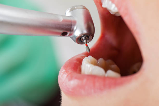 Best Emergency Treatment for Oral Infections in Piney Point Village, TX